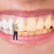 بلیچینگ دندان چیست؟