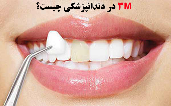 3M در دندانپزشکی چیست؟