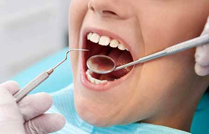 هر آنچه باید در مورد آینه های دندانپزشکی بدانید
