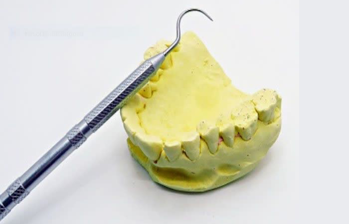انواع گچ های دندانی