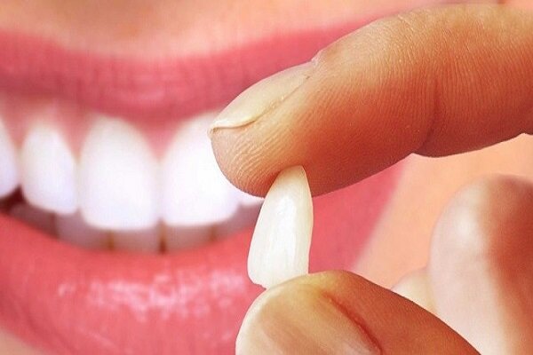 یک داروی ژاپنی که باعث می شود دندان بیشتری در بیاورید